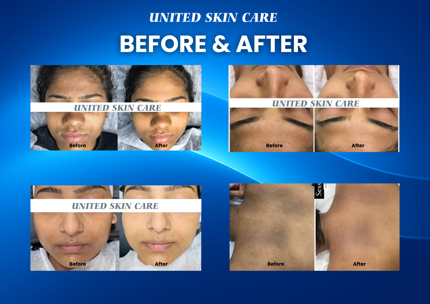 Dermaluxe Ultra 17 in One | Made in India | 3 Years Warranty | Advanced Medifacial System