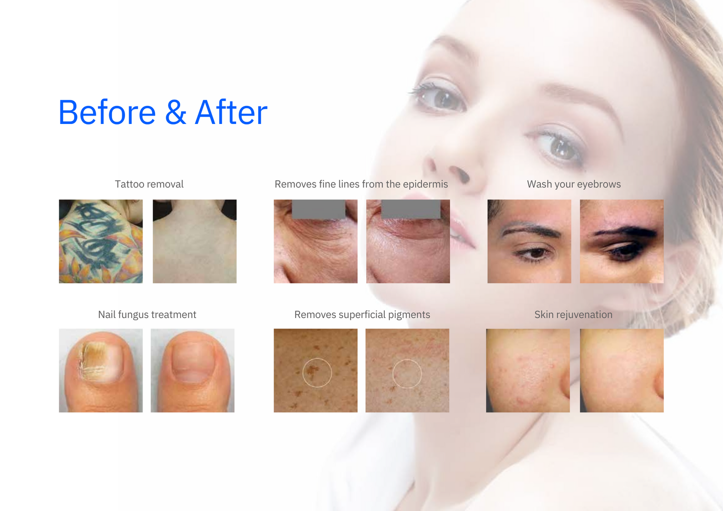 Quantus Picoluxe Ultra | US FDA Approved | 2 Years Warranty |