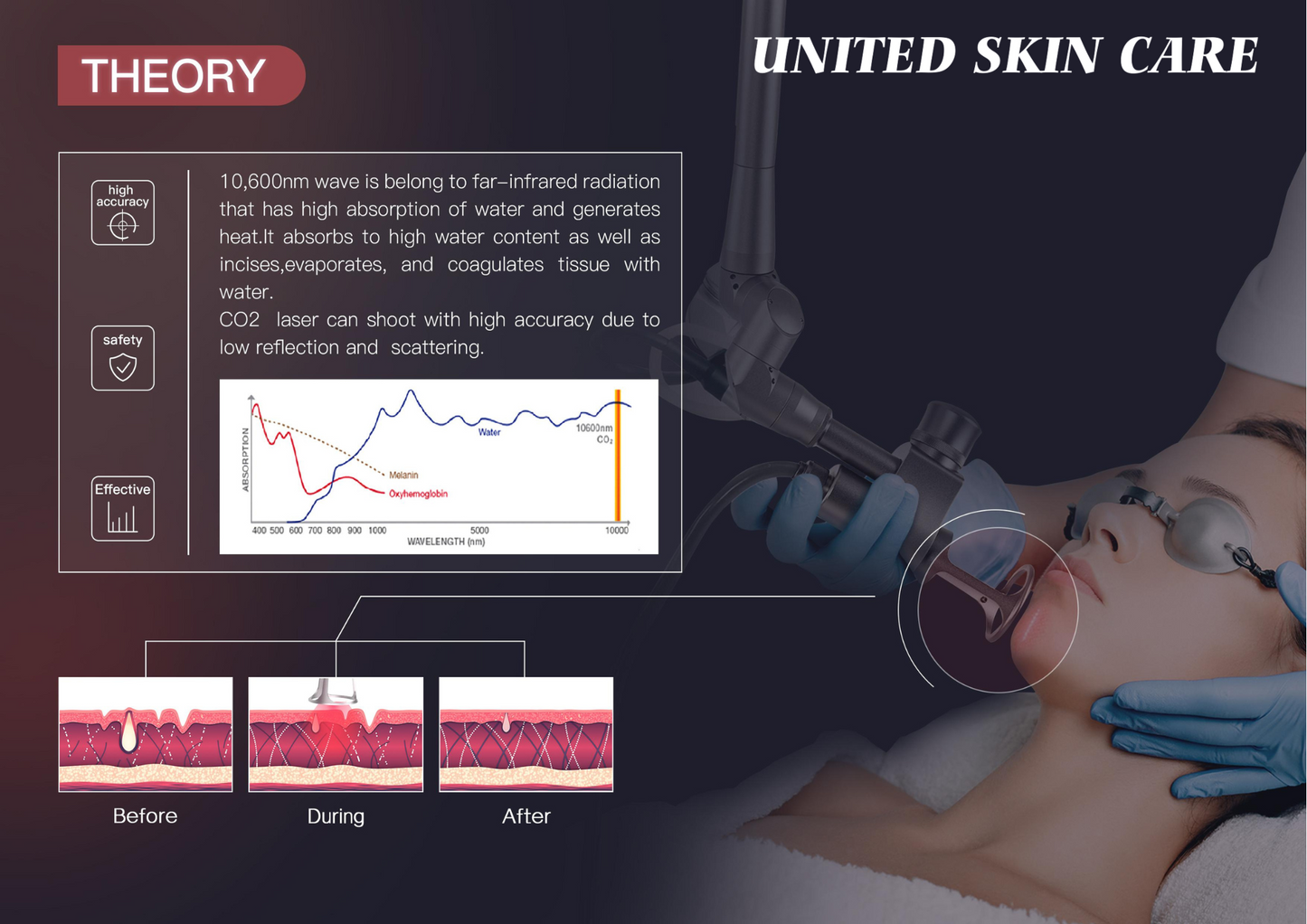 QUANTUS ULTRA BEAM CO2 | Advanced Fractional CO2 Laser Technology
