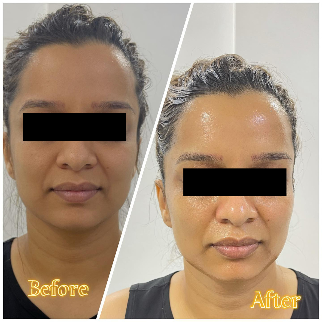 USC Oxygeno Machine 3 In One Super Facial