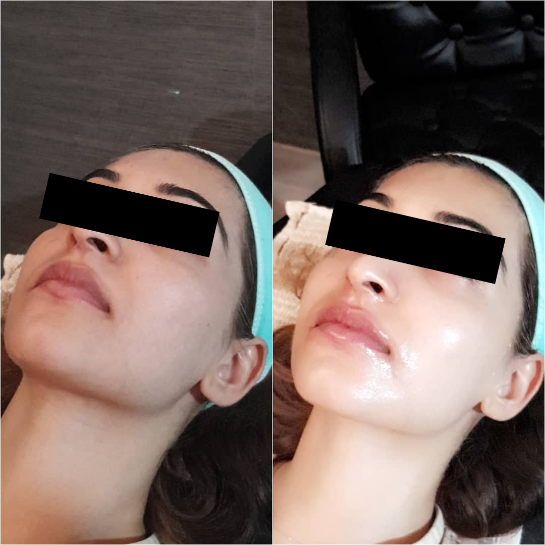 USC Oxygeno Machine 3 In One Super Facial