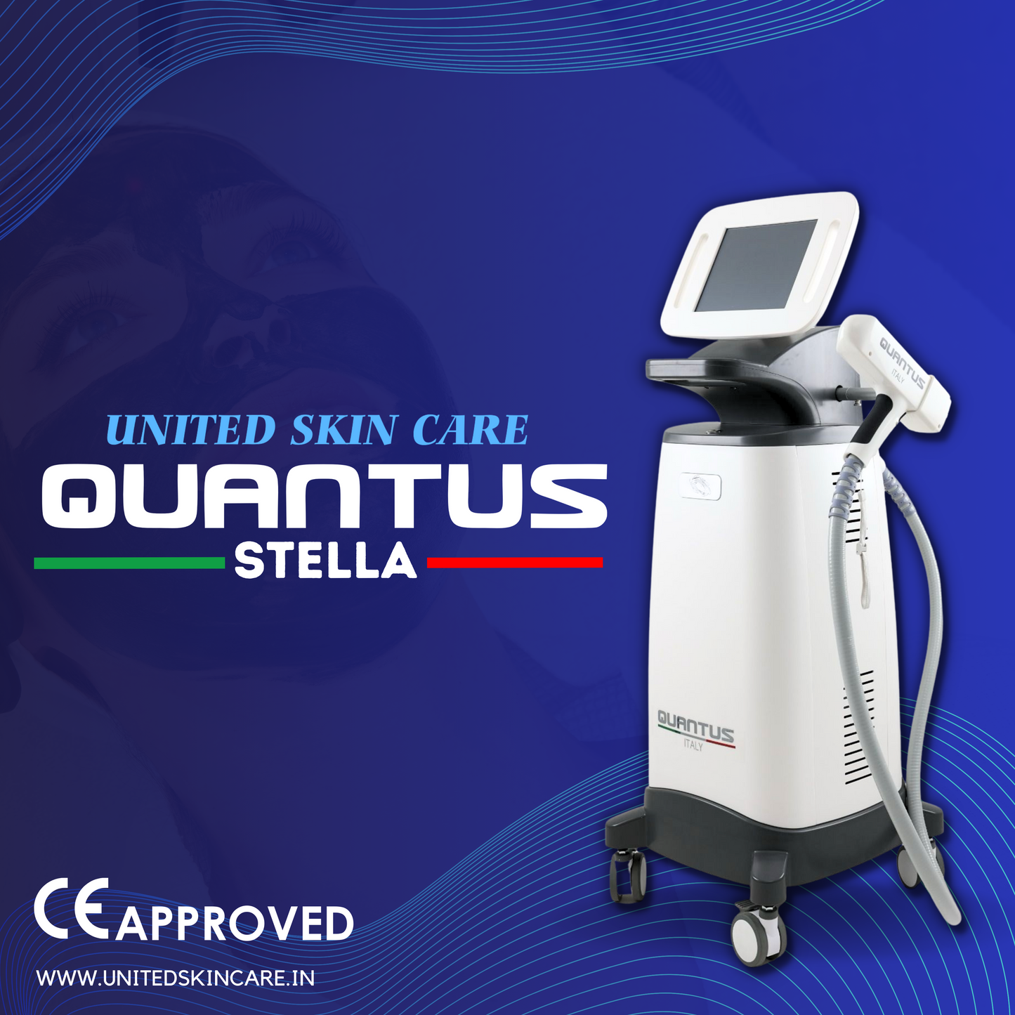 Quantus Stella QSWITCH NDYAG Laser