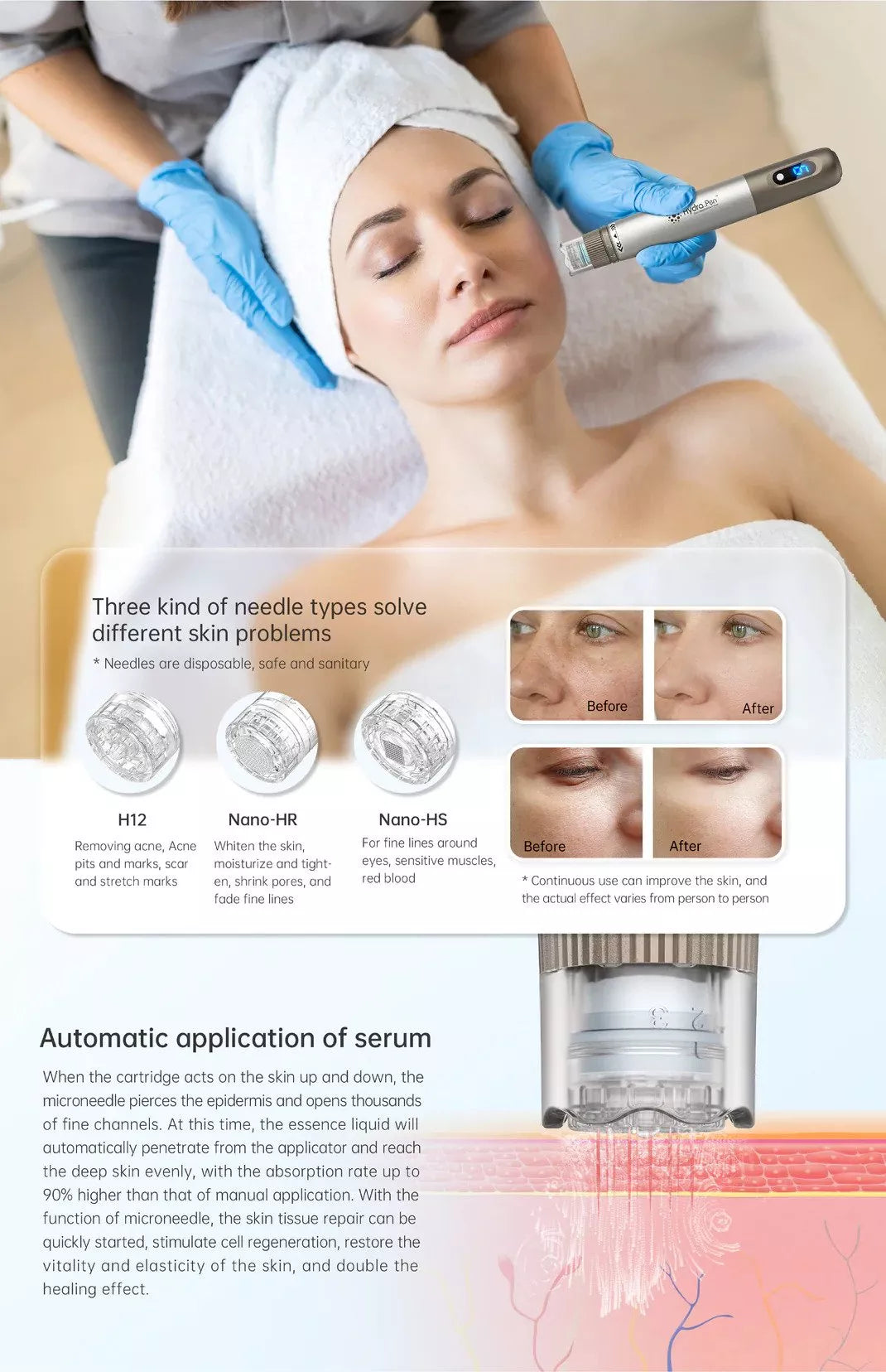 Hydra Pen H3 - Microneedling Device for Skin Texture and Acne Scars