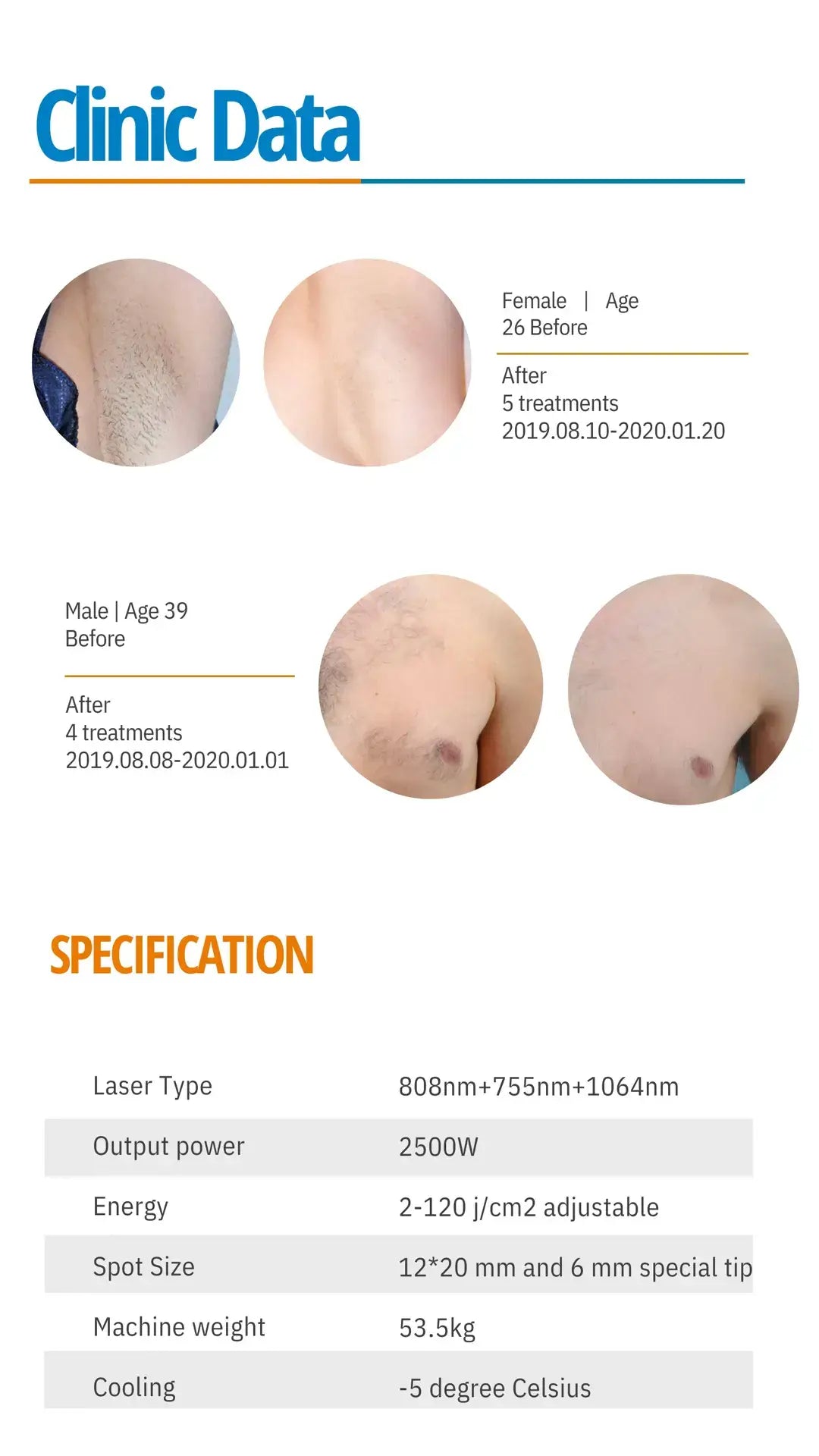 Quantus Trio Fda approved 1000w Triple wave Portable Diode Laser With Hyper Cooling