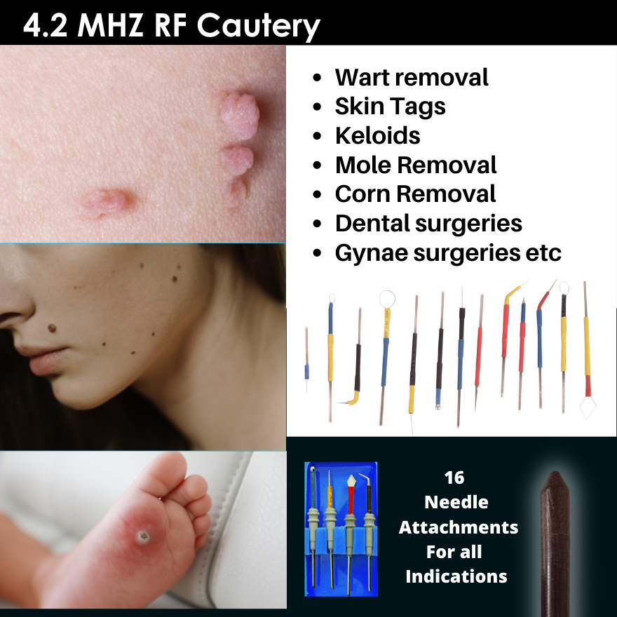 RF 4.2Mhz Cautery Machine Radio Frequency Cautery Machine