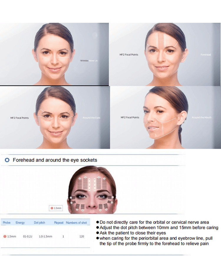 7D - Hifu Skin tightening and lifting machine
