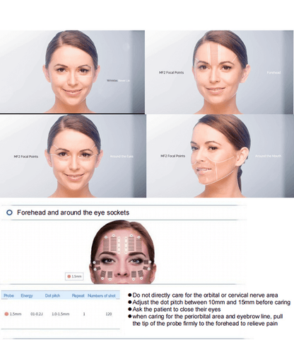 7D - Hifu Skin tightening and lifting machine
