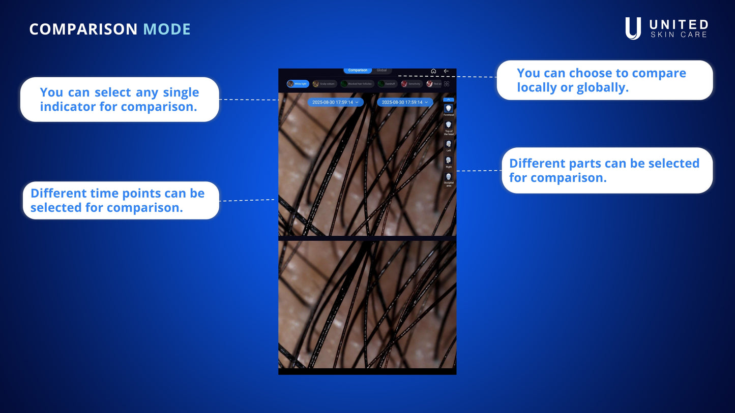 Quantus ScalpQ PRO | AI Intelligent Scalp Analyzer & Hair Follicle Detection System