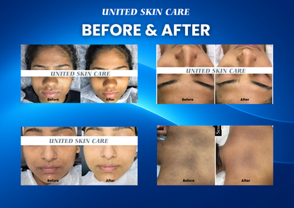 Dermaluxe Ultra 17 in One Hydra Facial | Made in India | 3 Years Warranty | Advanced Medifacial System