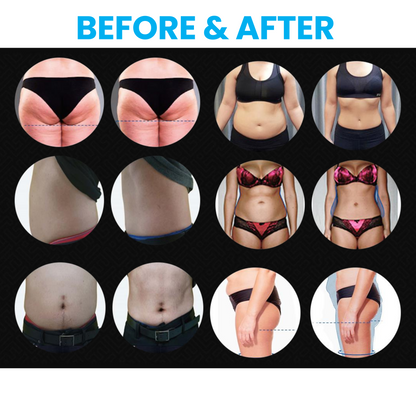 Quantus Cryosculpt 4D | Cryolipolysis with EM Sculpt