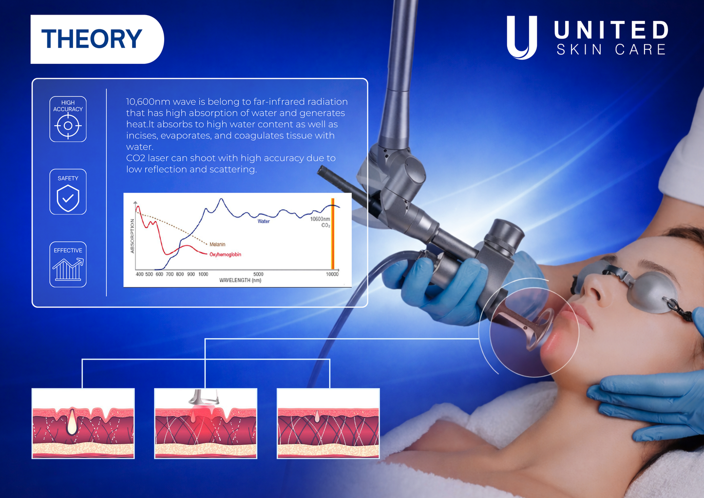 Quantus Ultra Beam CO2 Fractional Laser Machine | 60W True Power | 10600nm UltraPulse | Skin Resurfacing, Acne Scars, Pigment & Scar Removal | FDA & CE Approved | United Skin Care
