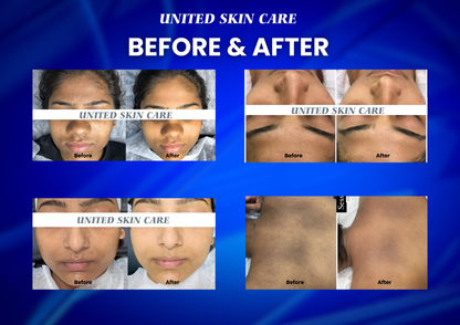 HydraLuxe 5 in One Hydra Facial |Crystal & Diamond MDA | Oxy Jet Spray | Hydro Facial MDA | Dandruff Exfoliator | 2 Years Replacement Warranty