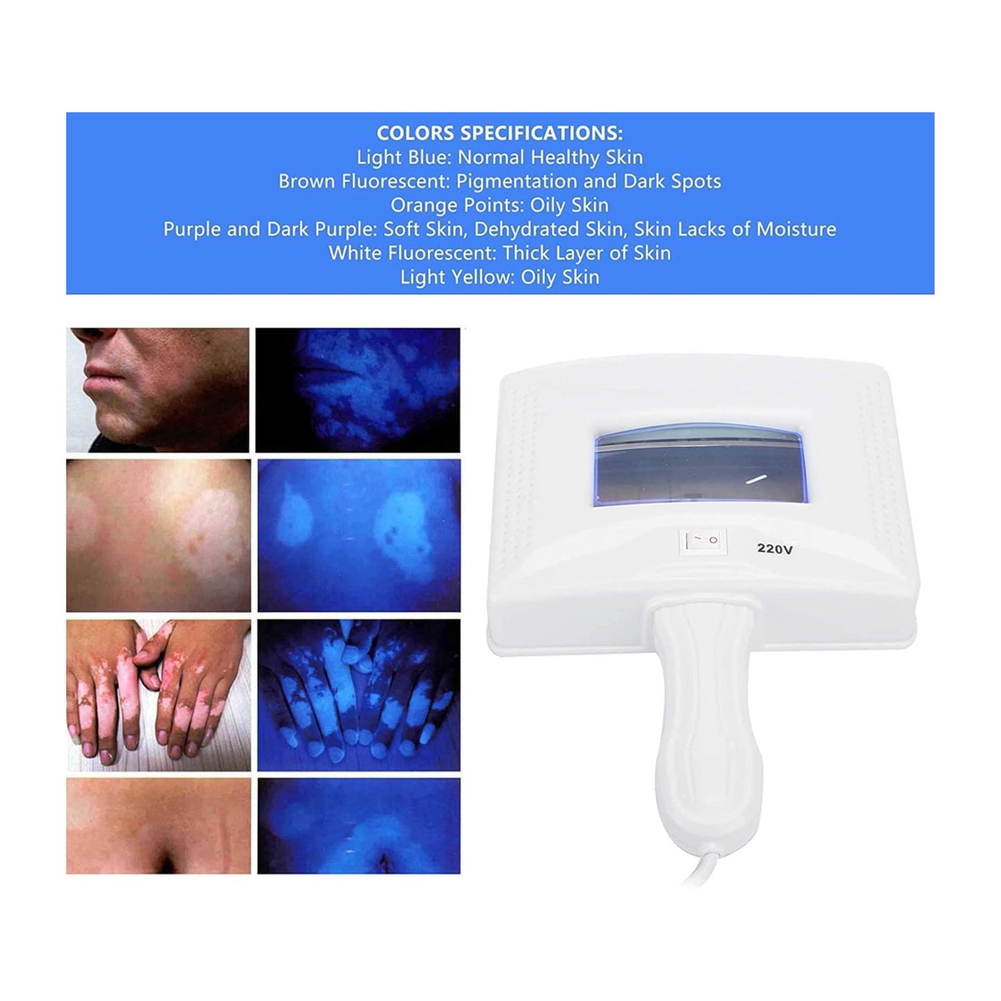 Woods Lamp For Skin Care Analyzer & Skin Examination