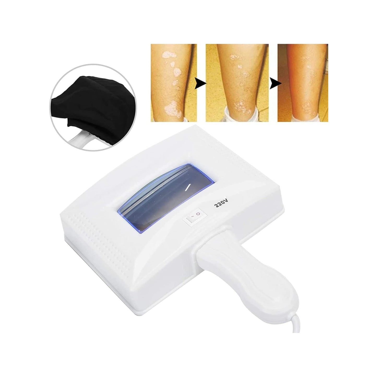 Woods Lamp For Skin Care Analyzer & Skin Examination