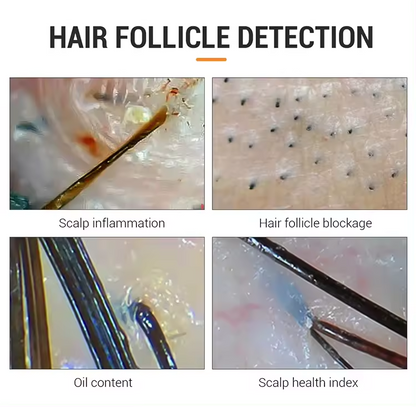 USC Professional Hair & Scalp Analyzer – HD Follicle Detection System