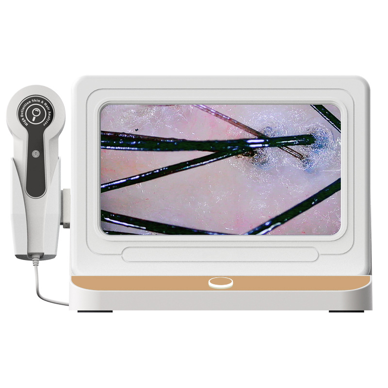 USC Professional Hair & Scalp Analyzer – HD Follicle Detection System