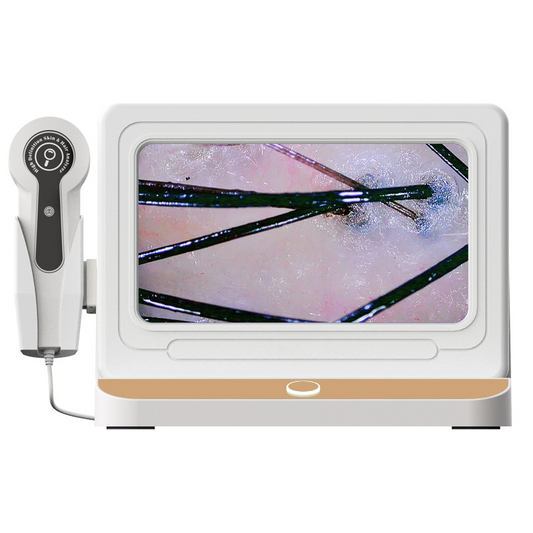 USC Professional Hair & Scalp Analyzer – HD Follicle Detection System