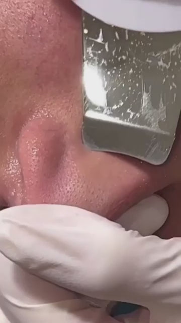 SONIC SKIN SCRUBBER