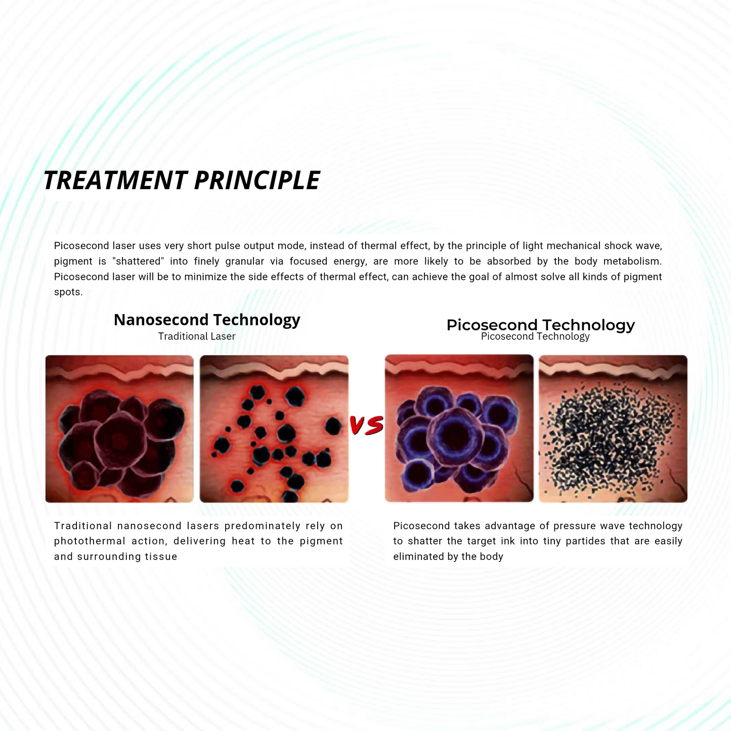 Quantus Pico Wave Pico Laser for Tattoo Removal ,Pigmentation, Melasma etc | QSwitch NdYag Laser | US FDA Approved Pico Laser System