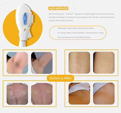 Portable IPL Laser Machine korean